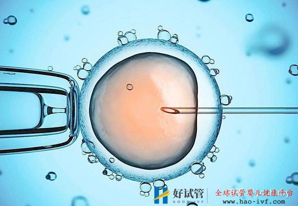 多囊患者做试管婴儿成功的机率大吗看完此篇你就有...(图4)