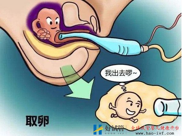 试管婴儿全流程介绍(图5)