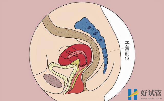 试管婴儿并不是人人都能做，要符合哪些条件？成功后要注意什么？(图1)