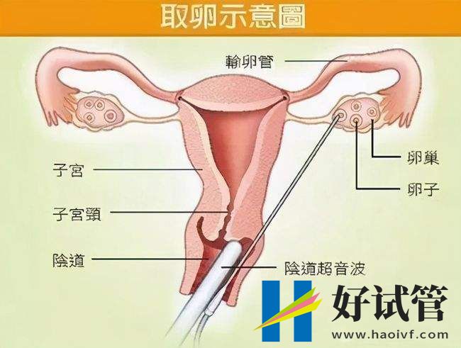 同卵双胞胎为什么不会是龙凤胎戳，科学解释其真正原因(图2)