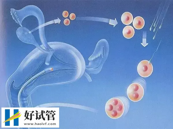 三代试管婴儿是目前最先进的试管婴儿技术