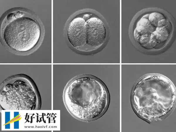 胚胎等级代表着胚胎的质量